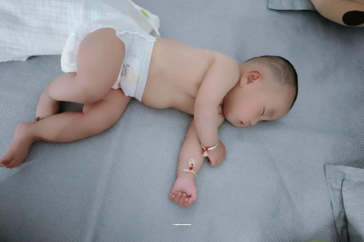阿勒泰六个月宝宝眼睛散光